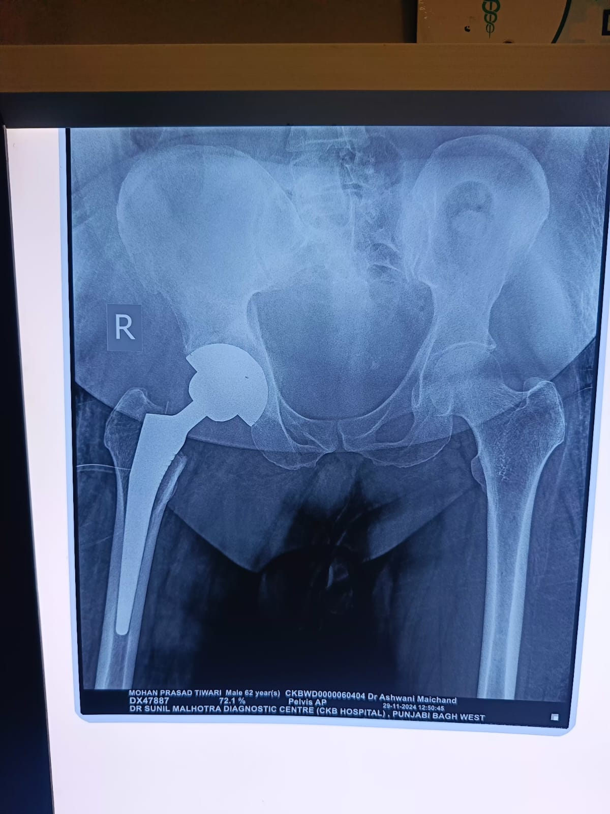 WhatsApp Image 2025-01-31 at 14.25.25