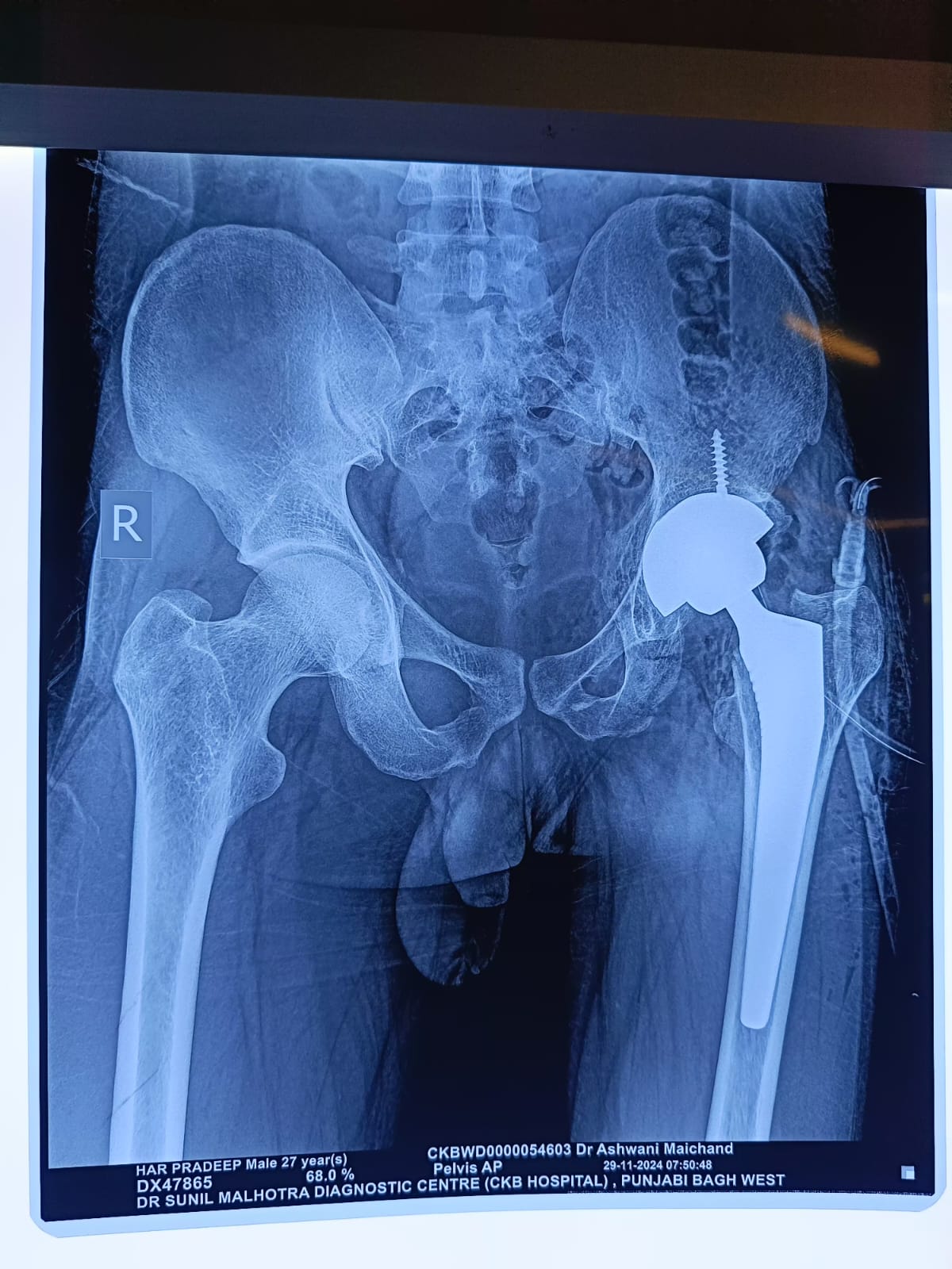 WhatsApp Image 2025-01-31 at 14.25.26 (1)