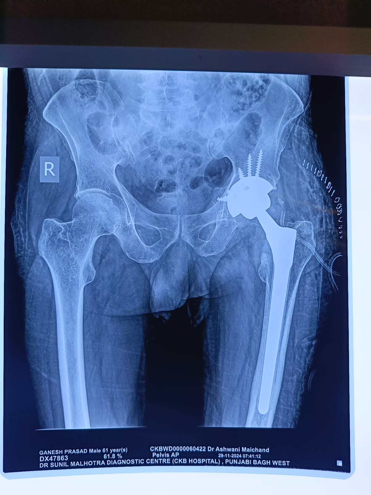 WhatsApp Image 2025-01-31 at 14.25.26