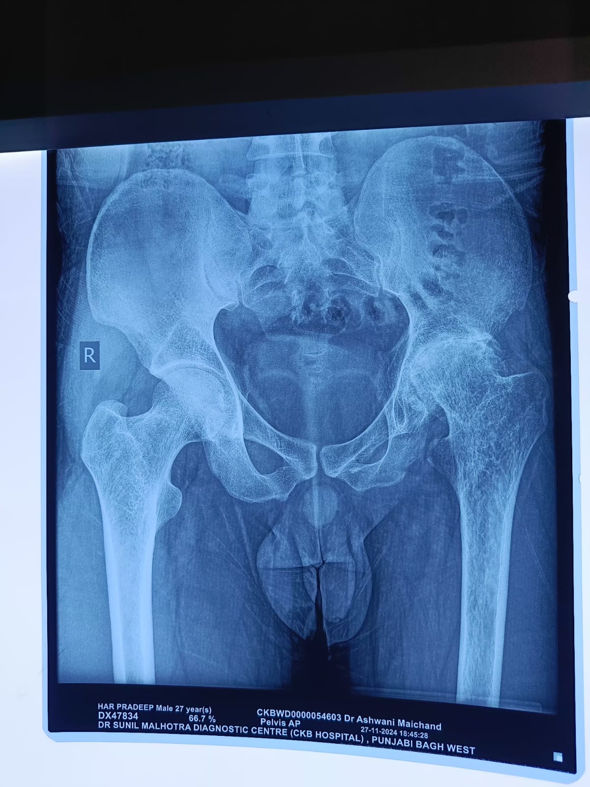 WhatsApp Image 2025-01-31 at 14.25.27