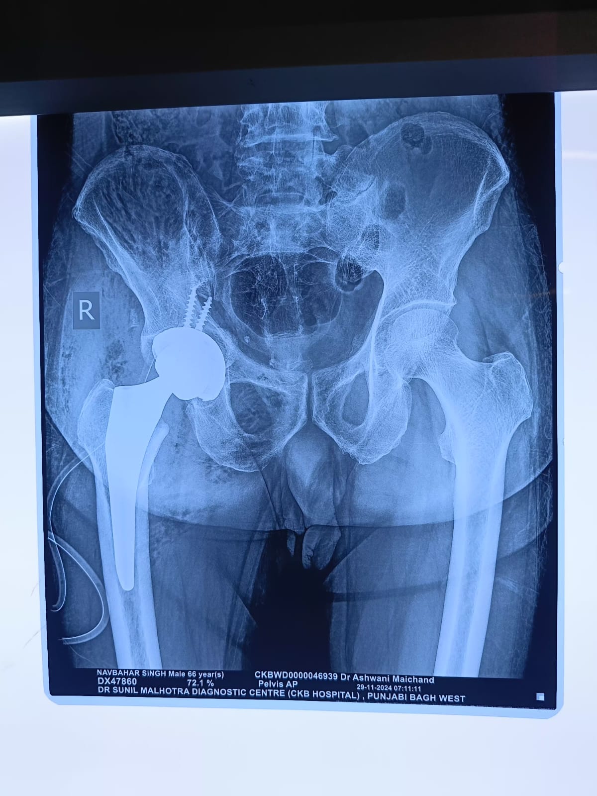 WhatsApp Image 2025-01-31 at 14.26.51