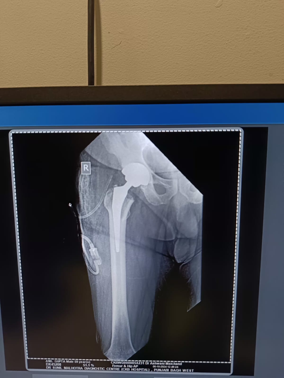 WhatsApp Image 2025-01-31 at 14.26.56