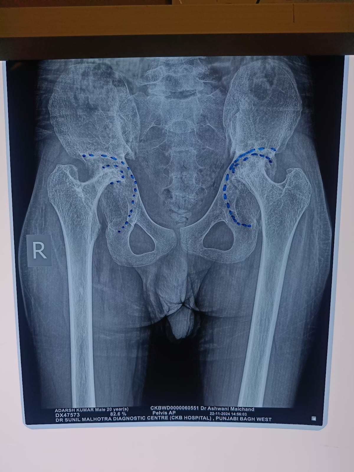 WhatsApp Image 2025-01-31 at 14.27.03