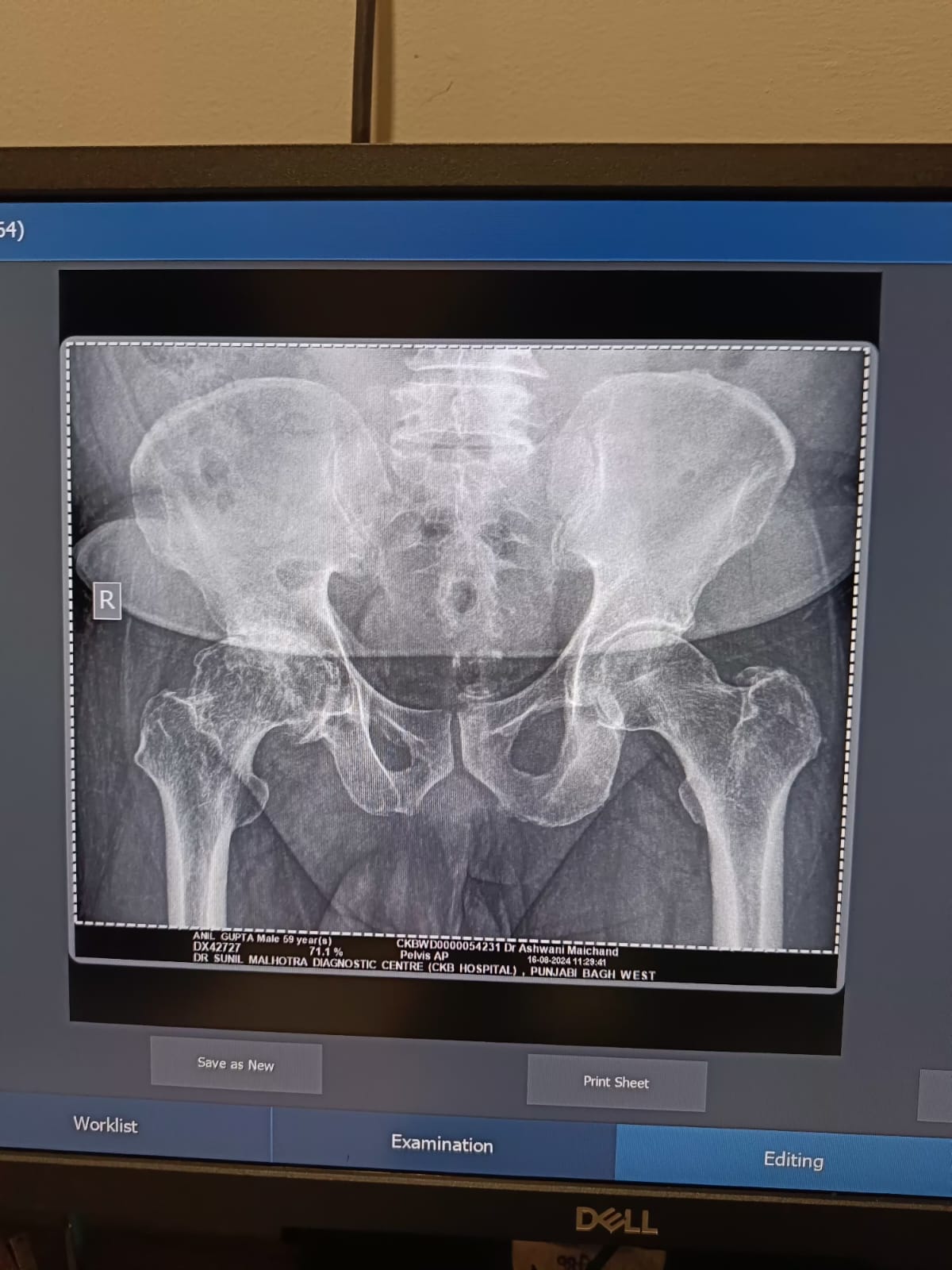 WhatsApp Image 2025-01-31 at 14.27.05