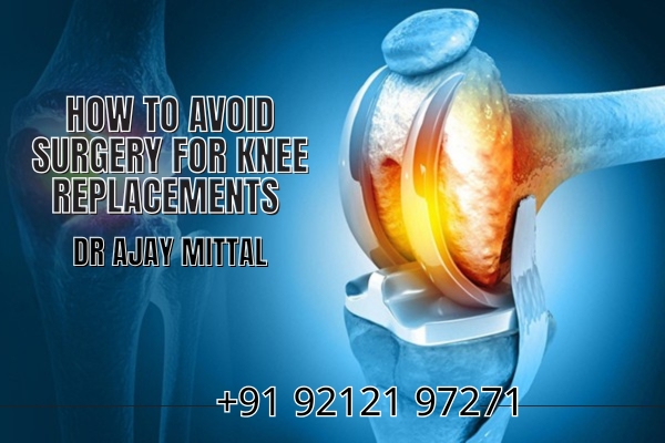 How to Avoid Surgery for Knee Replacements | Dr. Mittal