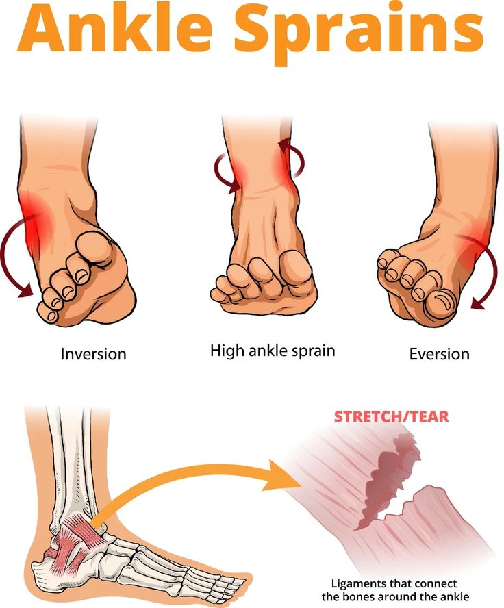 ankle injury treatment